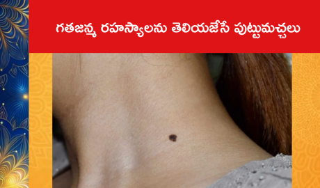 What does birthmarks indicate